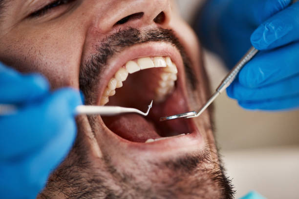 Best Walk-In Emergency Dental Services in Ecorse, MI